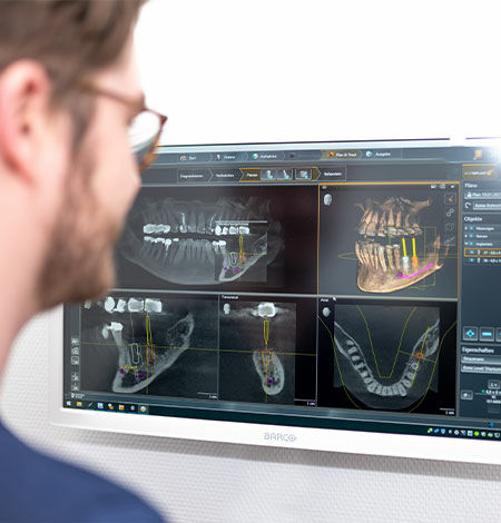 Eine Person mit Brille betrachtet zahnärztliche Röntgenaufnahmen auf einem Computerbildschirm. Das Display zeigt mehrere Bilder von Zähnen und Kieferstrukturen, wobei interessante Bereiche mit Farbmarkierungen hervorgehoben sind. Der Bildschirm steht vor einem hellen Hintergrund.