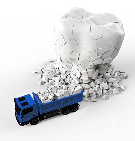 Eine große Skulptur eines abgebrochenen Zahns, um den herum kleine Fragmente verstreut sind. Neben der Skulptur steht ein blauer Kipplaster, der Teile des abgebrochenen Zahns transportiert. Der Hintergrund ist weiß.